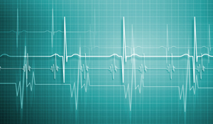 Heartbeat-variability-analysis